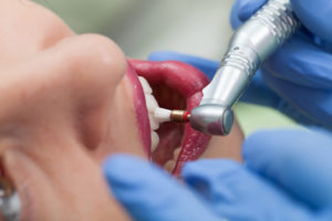 visiting dentist procedure | Newton Village Dental Clinic
