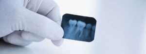 Dental X-Ray | Newton Village Dental Clinic Surrey