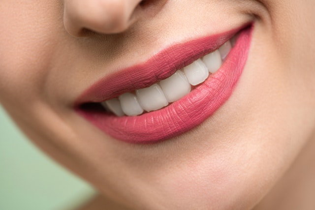 Teeth Whitening and Sensitivity | Newton Village Dental clinic